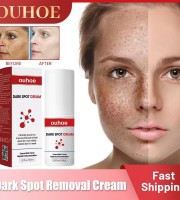Dark Spot Remover Cream